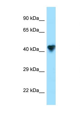 Carboxypeptidase O / CPO Antibody (aa111-160)