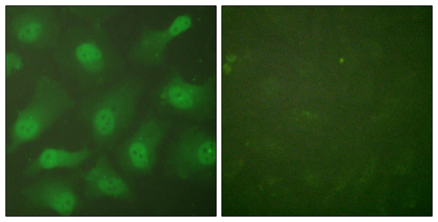 IHC-plus™ CSE1L Antibody (aa1-50)