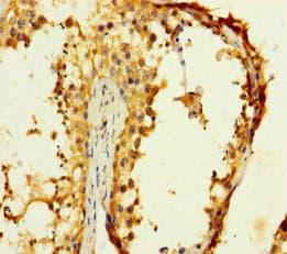 Polyclonal Rabbit anti-Human CST11 Antibody