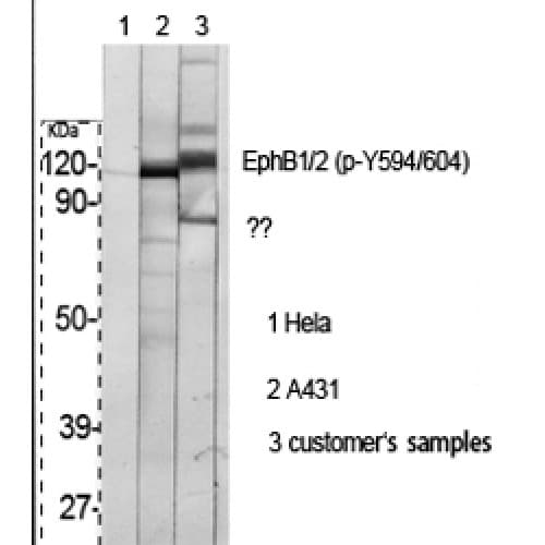 Polyclonal Rabbit anti-Human EPH Receptor B1+B2 Antibody (530-610 aa, IF, WB)
