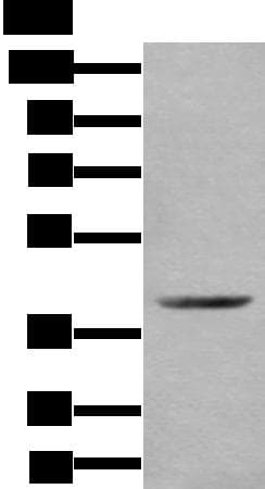 Polyclonal Rabbit anti-Human WDFY2 Antibody (IHC, WB)