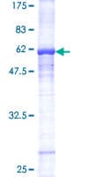 Human PPARA / PPAR Alpha Protein (Recombinant GST)