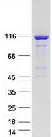 Human ARHGEF1 Protein (Recombinant Myc-DDK (Flag))