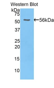 HGFAC / HGFA Antibody (aa363-622)