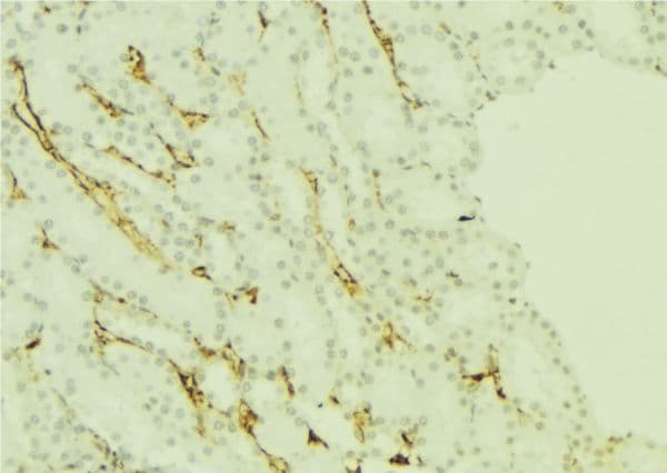 PRG2 / Proteoglycan 2 Antibody