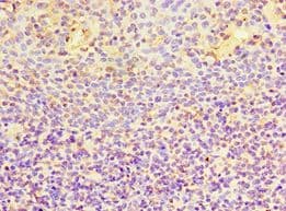 Polyclonal Rabbit anti-Human EWSR1 / EWS Antibody (aa1-300, IHC)
