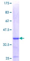 Human LIMS1 / PINCH Protein (Recombinant GST, N-terminus)