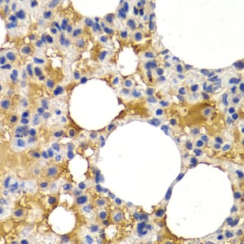 IHC-plus™ PPP1R1B / DARPP-32 Antibody