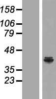 NDUFAF5 Protein (Over-Expression Lysate Myc-DDK (Flag))