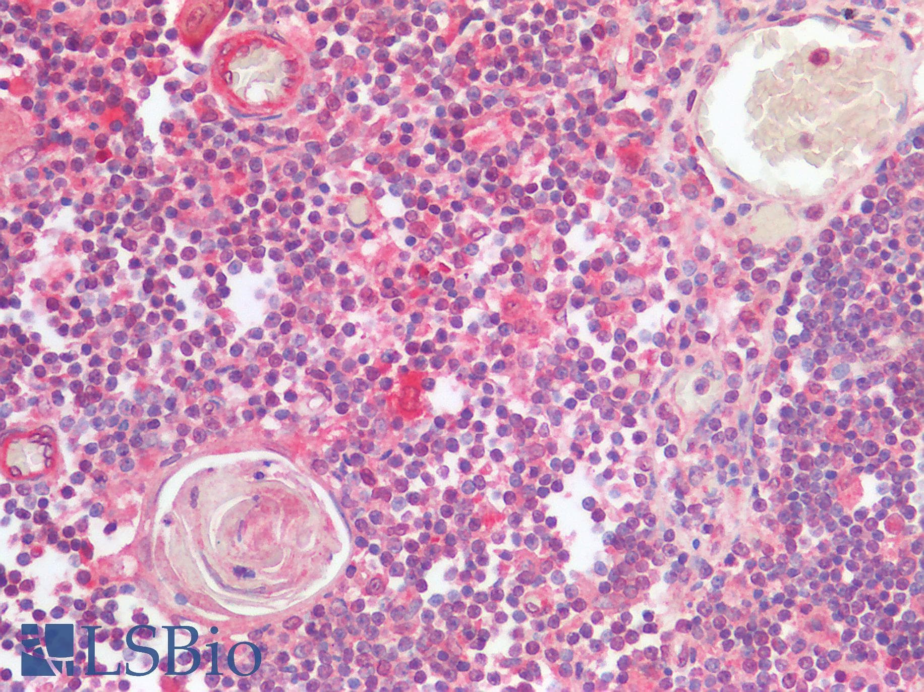 IHC-plus™ TIGIT Antibody