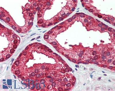 IHC-plus™ Polyclonal Rabbit anti-Human IKBKAP / IKAP Antibody (aa1150-1200, IHC, WB)