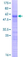 Human TBRG1 Protein (Recombinant GST)