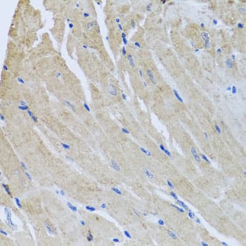 SRI / Sorcin Antibody