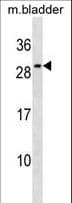 IL27 Antibody (aa124-150)