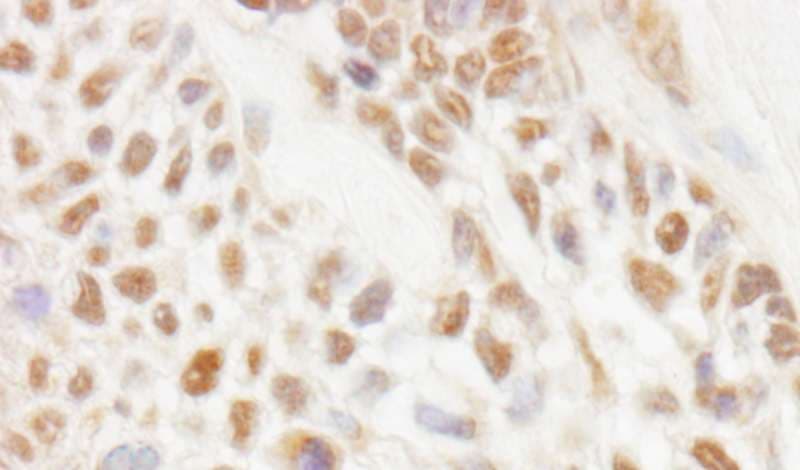 JMJD1C Antibody (aa150-200)