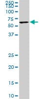 USP14 Antibody (clone 1F8)