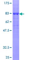 Human RGS6 Protein (Recombinant GST)