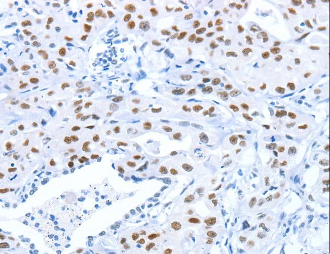 Polyclonal Rabbit anti-Human ARID1A / BAF250 Antibody (aa95-108, IHC)