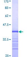 Human TMEPAI / PMEPA1 Protein (Recombinant GST, N-terminus)