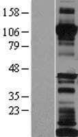 CDH17 / Cadherin 17 Protein (Over-Expression Lysate Myc-DDK (Flag))