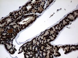PCNA Antibody (clone OTI6A10)
