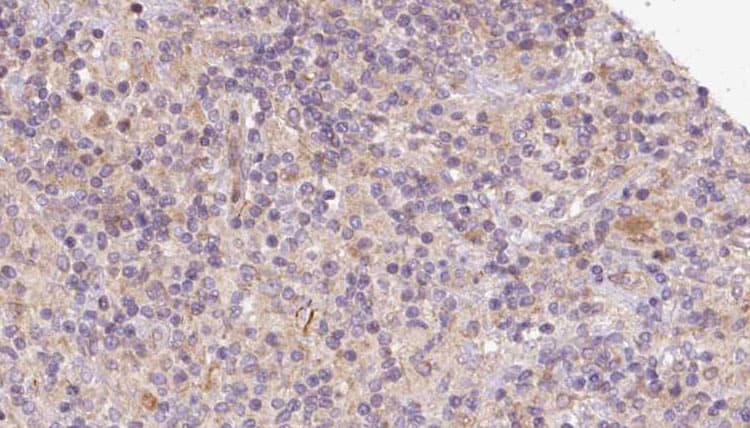 Polyclonal Rabbit anti-Human CHCHD6 Antibody (IHC, WB)