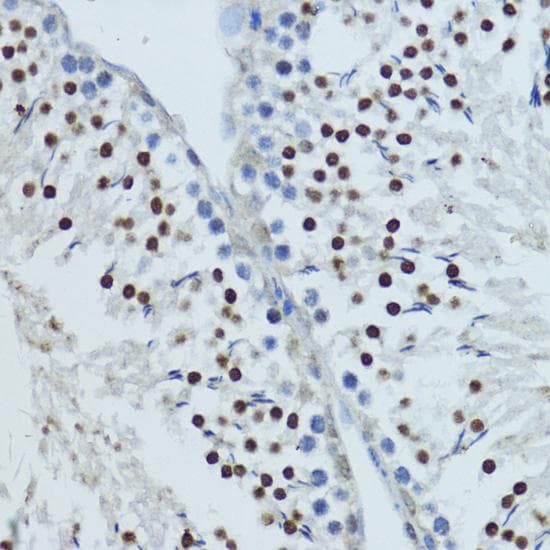 NR1I3 / CAR Antibody