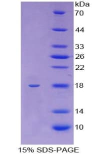 Human Kinesin 5A / KIF5A Protein (Recombinant His, N-Terminal)