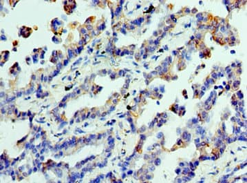CLTA / LCA Antibody