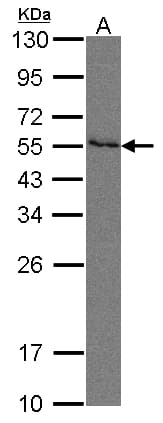 IHC-plus™ Polyclonal Rabbit anti-Human PVRL2 / CD112 Antibody (aa270-499, IHC, WB)