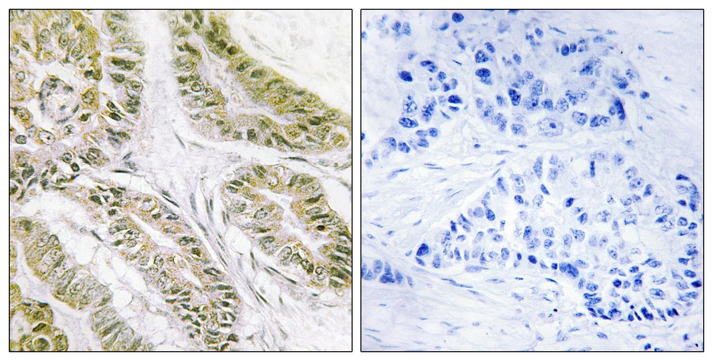 Polyclonal Rabbit anti-Human BAX Antibody (aa80-129, IHC, IF)