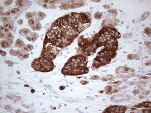 N4BP2L2 Antibody (clone OTI6A9, Carrier-free)