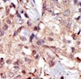 Polyclonal Rabbit anti-Human MYLK Antibody (aa923-953, IHC, WB)
