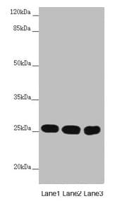 Polyclonal Rabbit anti-Human CHCHD3 Antibody (IHC, WB)