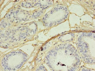 Polyclonal Rabbit anti-Human SKP2 Antibody (aa1-424, IHC, WB)