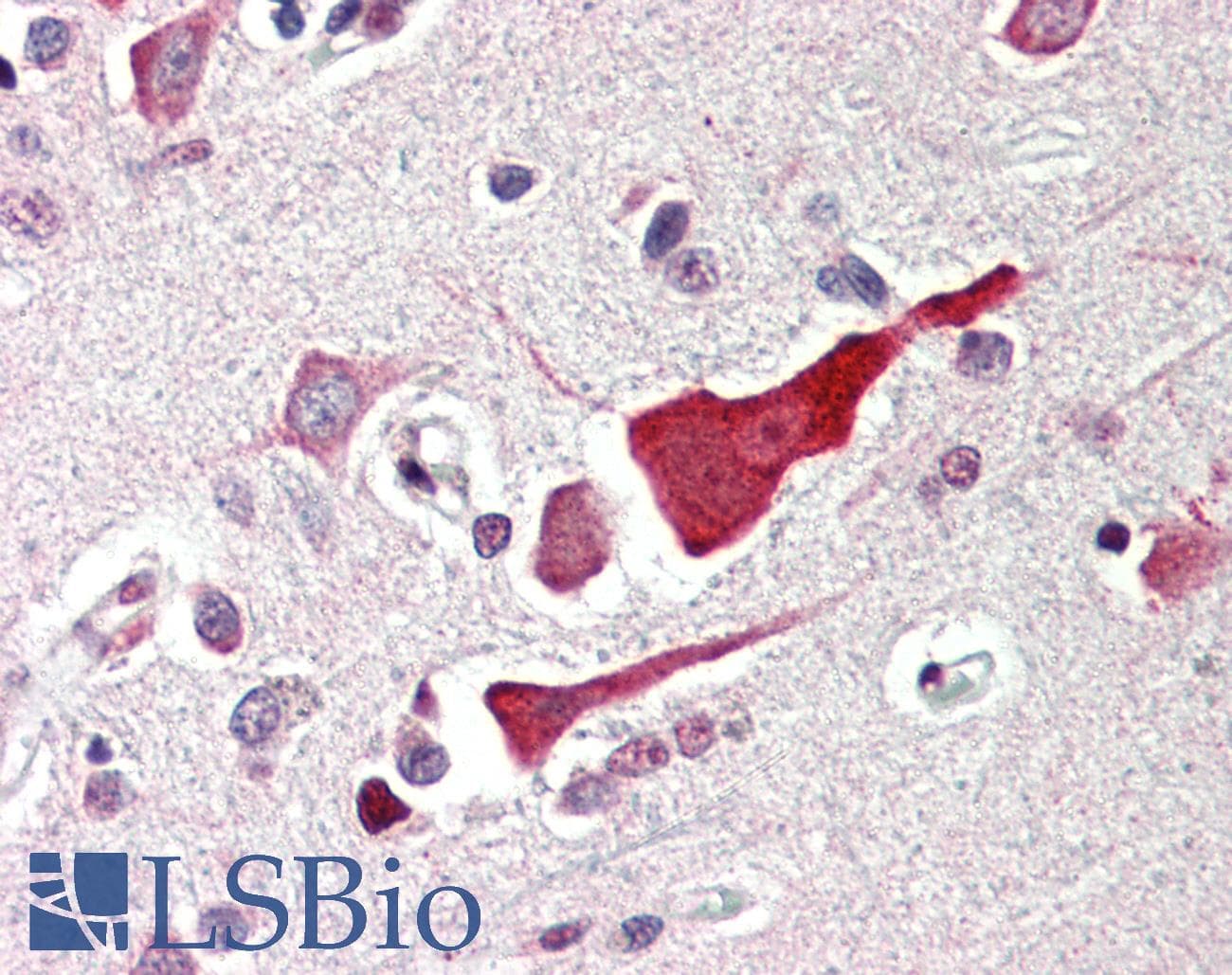IHC-plus™ BCL2L10 / Diva Antibody