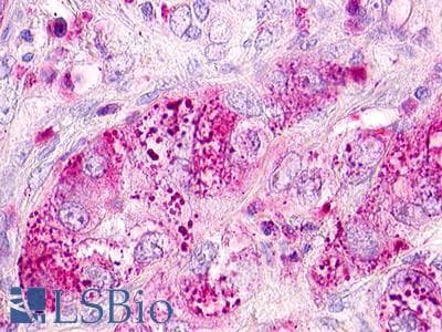PathPlus™ MLNR/GPR38/Motilin Receptor Antibody (Internal)