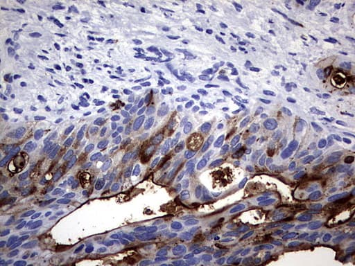 CEACAM5 / CD66e Antibody (aa35-680, clone OTI2B12)