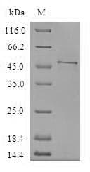 Human CFAP20 / GTL3 Protein (Recombinant GST, N-terminus)