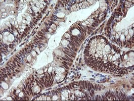 NDOR1 Antibody (clone OTI1E3)