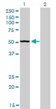 Monoclonal Mouse anti-Human BAR / BFAR Antibody (clone 1C6, IHC, WB)