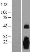 MARCH3 Protein (Over-Expression Lysate Myc-DDK (Flag))