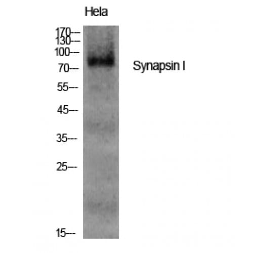 SYN1 / Synapsin 1 Antibody (1-80 aa)