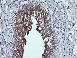 DNM1L / DRP1 Antibody (clone OTI3F4)