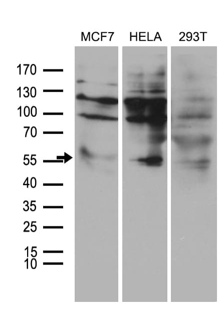 ESR2 / ER Beta Antibody (aa1-260, clone OTI2E12)