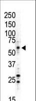 MAPK8 / JNK1 Antibody (aa358-389)