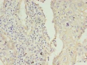 KRT8 / CK8 / Cytokeratin 8 Antibody (aa19-148, FITC)