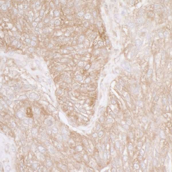 Polyclonal Rabbit anti-Human RPS3A / Ribosomal Protein S3A Antibody (aa214-264, IHC, WB)