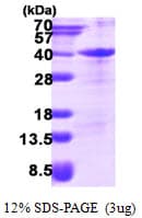 Human ZFAND3 / TEX27 Protein (Recombinant His)