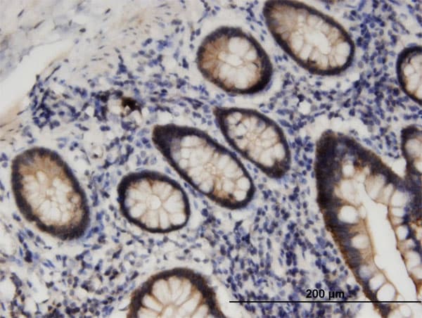 Monoclonal Mouse anti-Human STK38L / NDR2 Antibody (clone 4E5, IHC, WB)